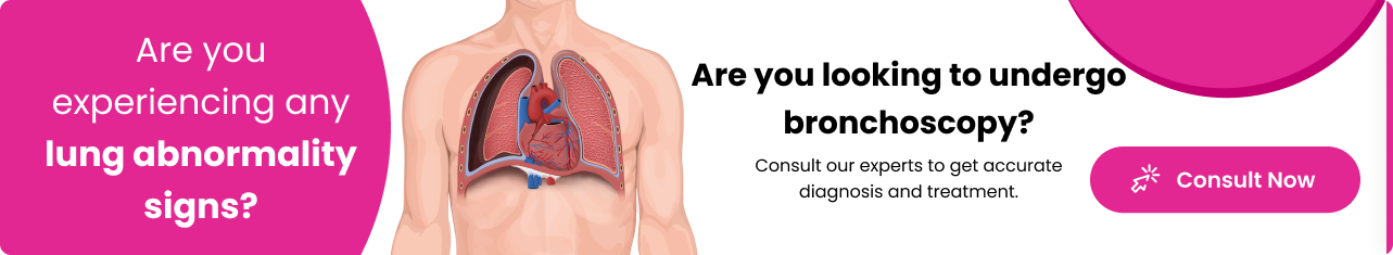 Bronchoscopy - Sriramakrishnahospital
