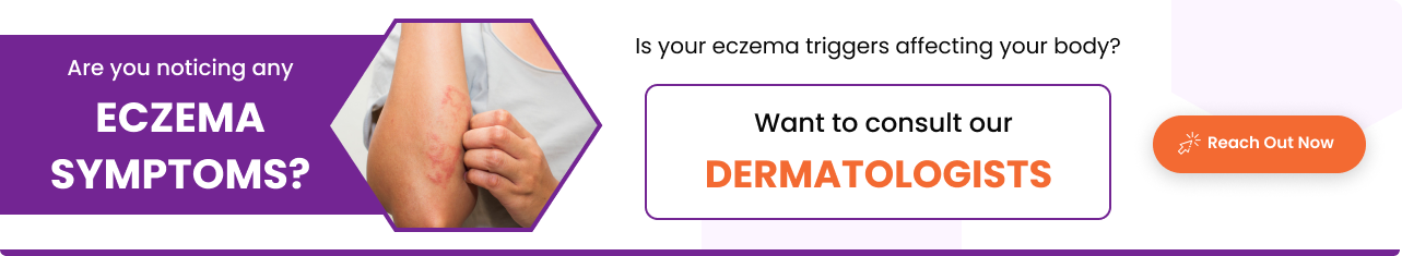 Eczema treatment - Sriramakrishnahospital