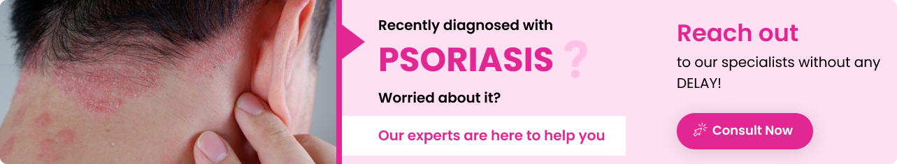 Psoriasis - Sriramakrishnahospital