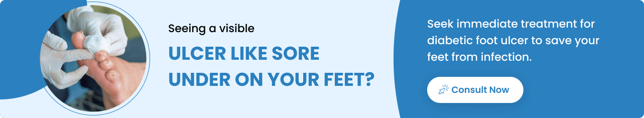 Diabetic Foot Ulcer - Sriramakrishnahospital
