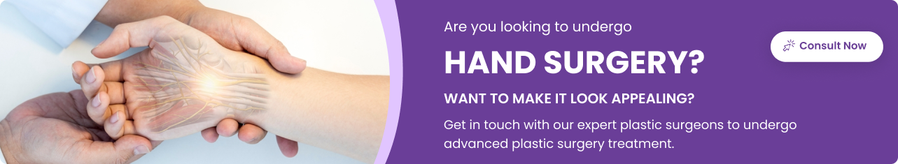 Hand Surgery - Sriramakrishnahospital