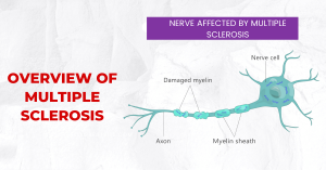 Multiple Sclerosis - Sriramakrishnahospital