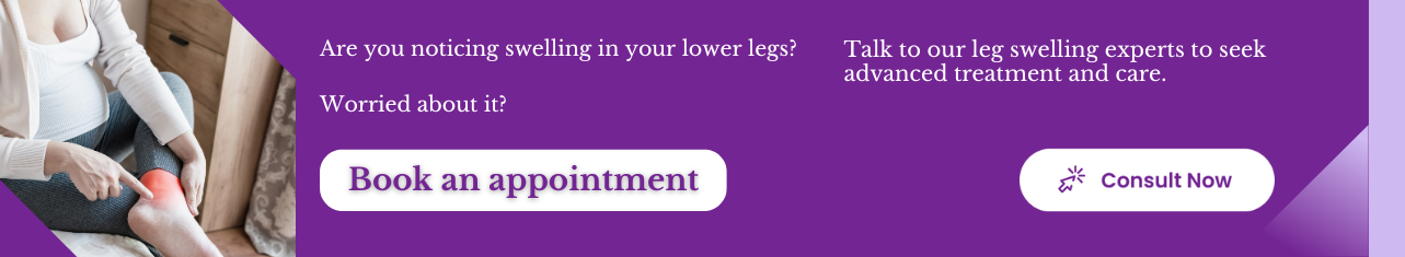 Lower-Extremity Edema-Sriramakrishnahospital