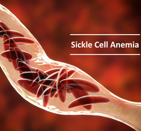 sickle cell anemia treatment in coimbatore