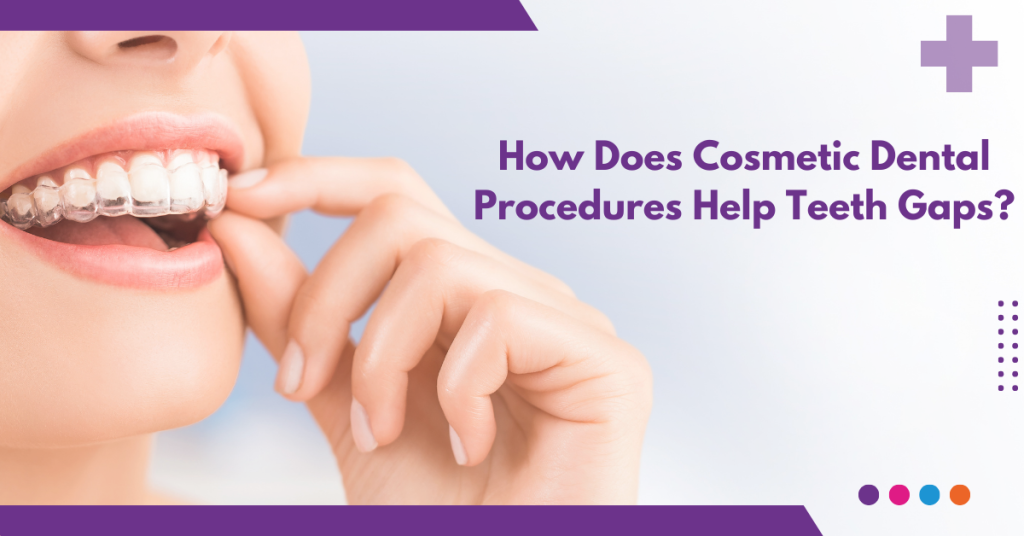 How Does Cosmetic Dental Procedures Help Teeth Gaps?