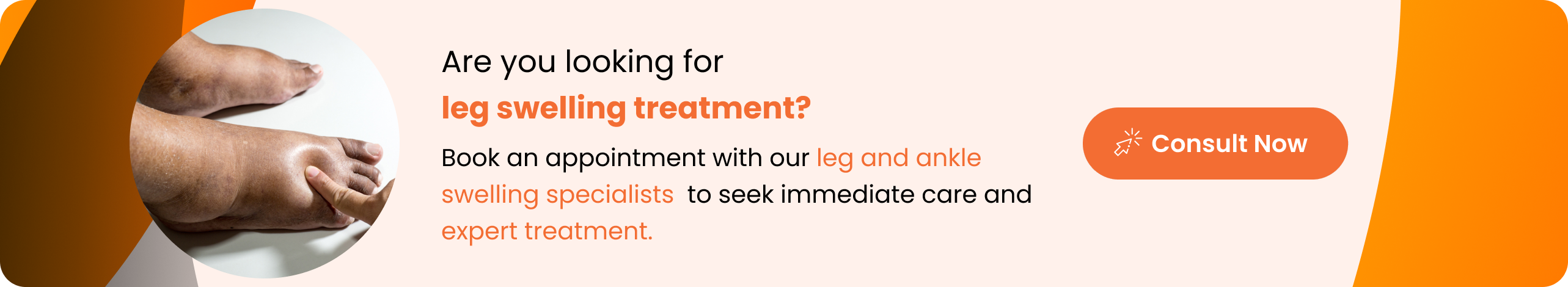 swollen legs and ankles - Sriramakrishnahospital
