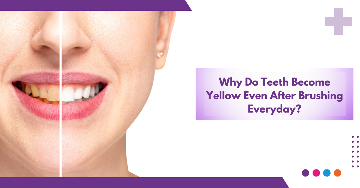 Why Do Teeth Become Yellow Even After Brushing Everyday?