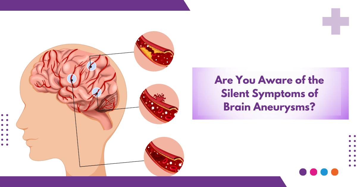 Are You Aware of the Silent Symptoms of Brain Aneurysms?