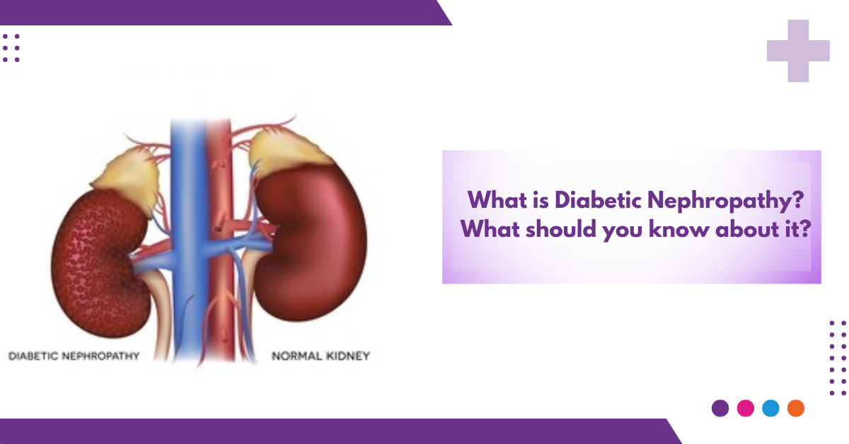 What is Diabetic Nephropathy? What Should You Know About it?