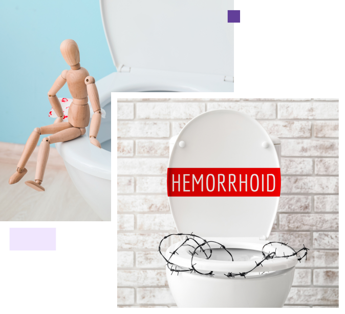 Piles Treatment in Coimbatore Best Piles Hospital