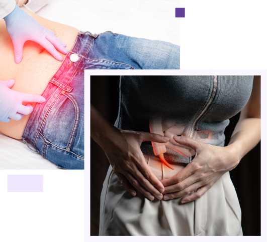 Appendix Surgery in Coimbatore | Appendix Hospital in Coimbatore