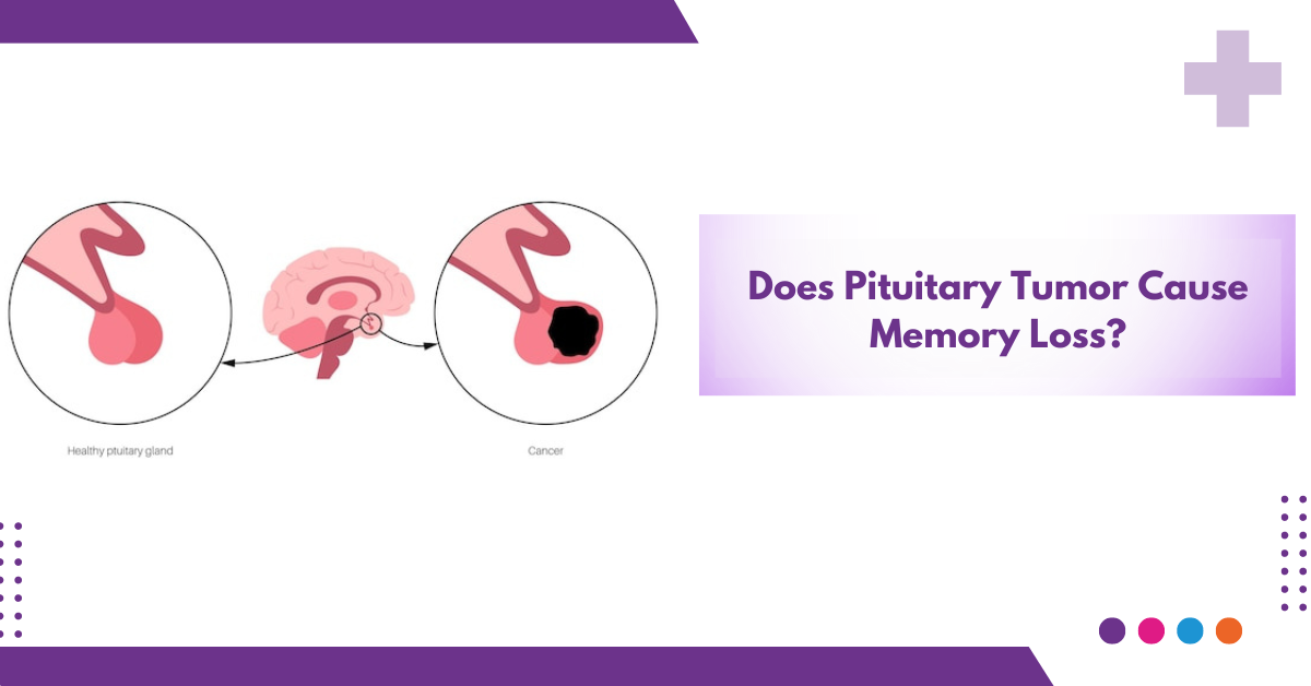 Does Pituitary Tumor Cause Memory Loss?