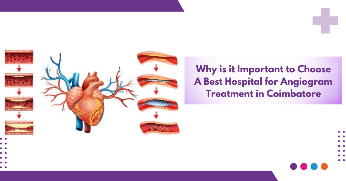 Why Is It Important To Choose A Best Hospital For Angiogram Treatment In Coimbatore