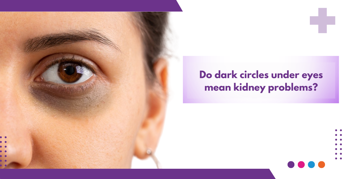 Do Dark Circles Under Eyes Mean Kidney Problems?