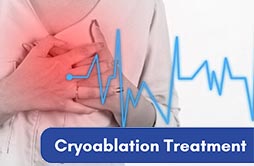Cryoablation Treatment in Coimbatore