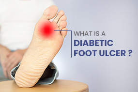 Diabetic foot ulcer treatment in coimbatore