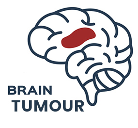 Brain Tumour Treatment in Coimbatore