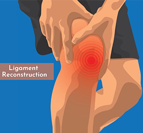 Ligament Reconstruction - Sri Ramakrishna Hospital