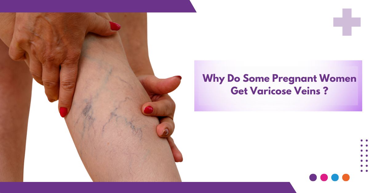 Why Do Some Pregnant Women Get Varicose Veins ?