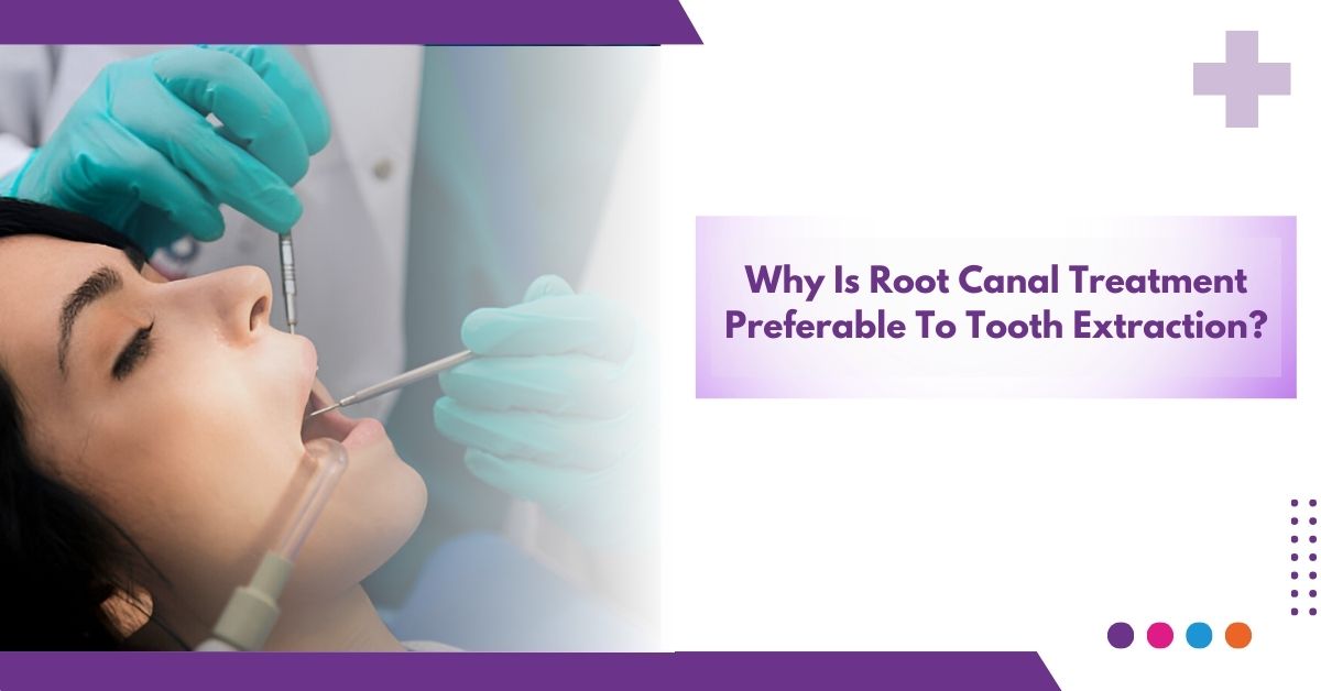 Why Is Root Canal Treatment Preferable To Tooth Extraction ?