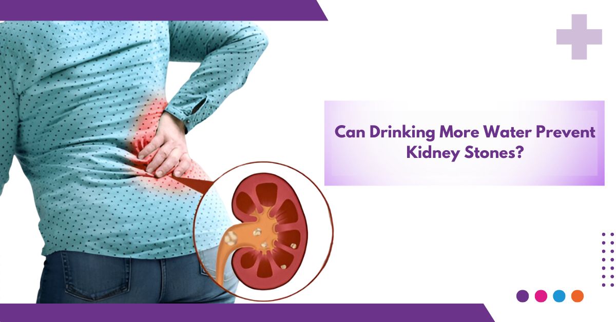 Can Drinking More Water Prevent Kidney Stones ?