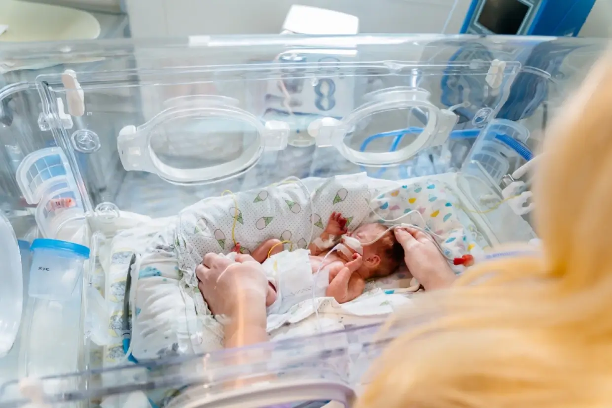 Premature Birth Treatment in Coimbatore | Preterm Care