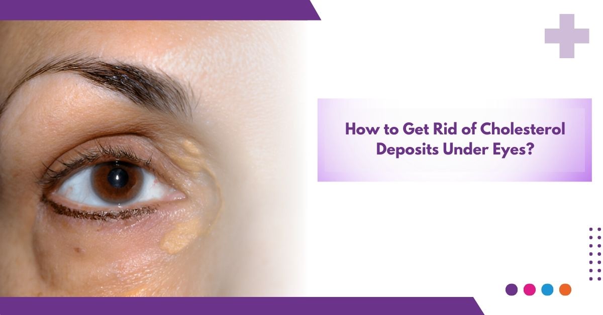 How To Get Rid Of Cholesterol Deposits Under Eyes ?