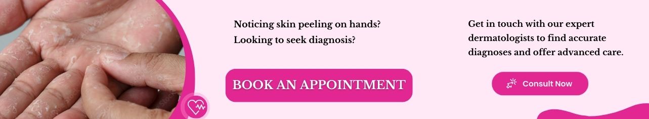 skin peeling on hands