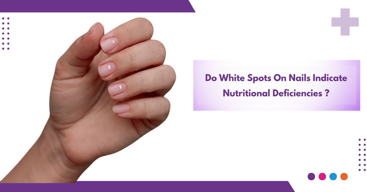 White Spot on Nails
