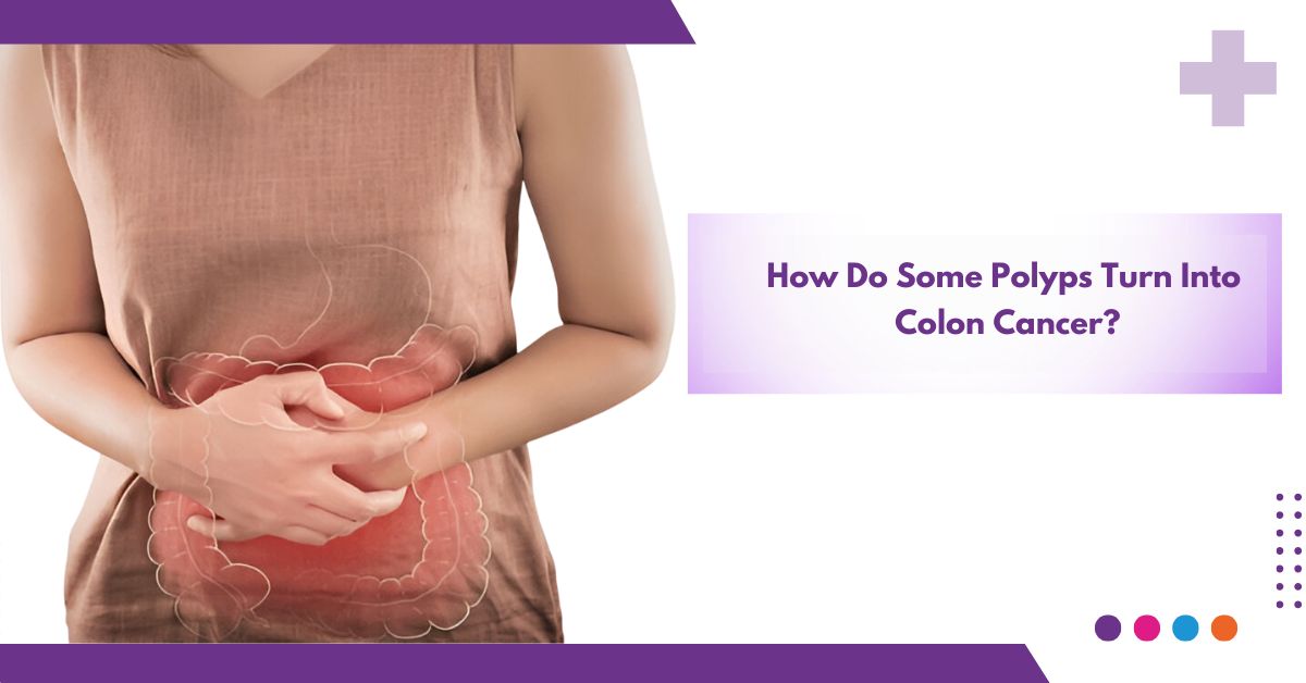 How Do Some Polyps Turn Into Colon Cancer ?