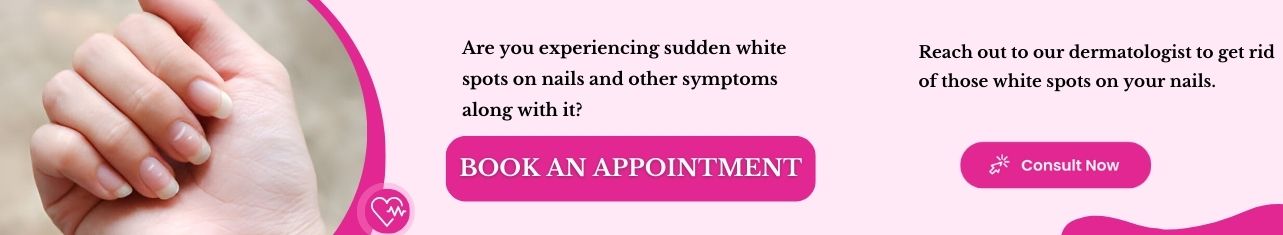 White Spot on Nails Treatment