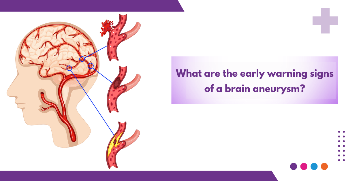 warning signs of a brain aneurysm