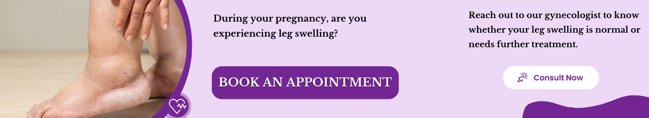Is Leg Swelling Normal During Pregnancy