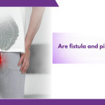 Are fistula and piles the same?