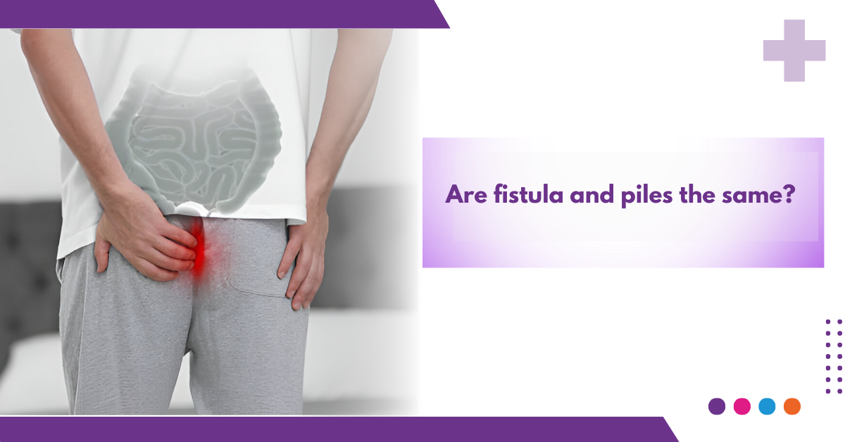 Are fistula and piles the same?
