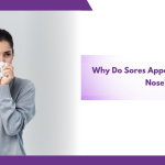 Cold sores inside nose