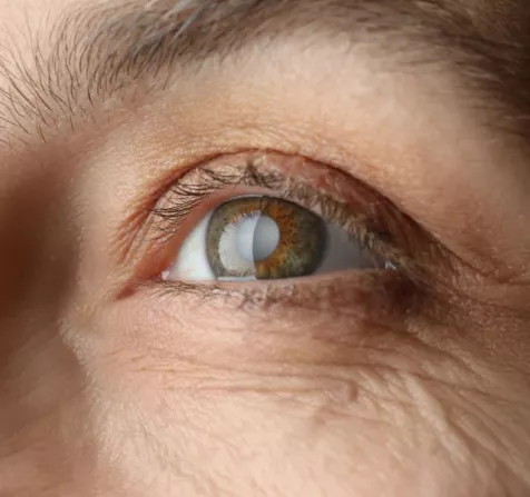 best glaucoma specialist in coimbatore