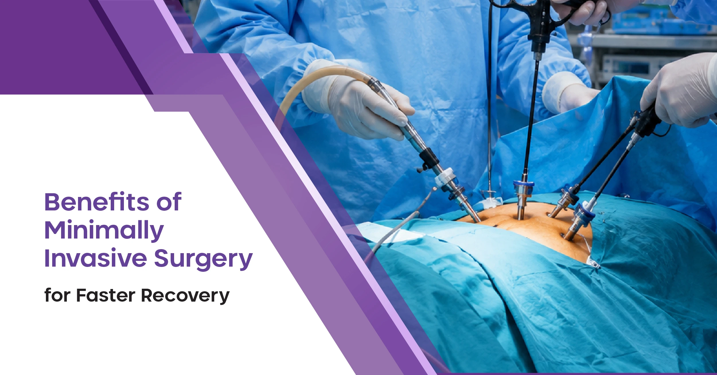 Benefits of Minimally Invasive Surgery for Faster Recovery