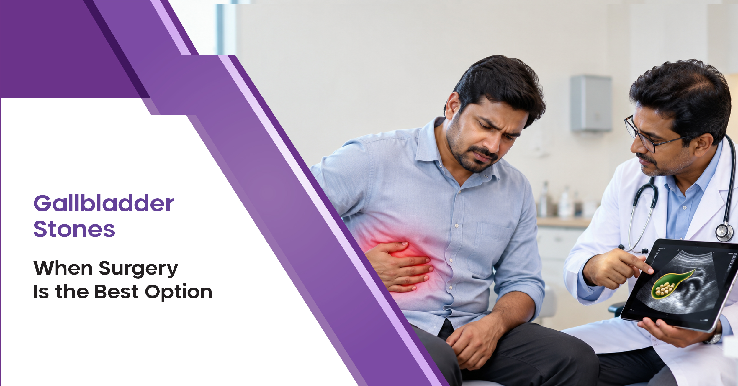 Gallbladder Stones: When Surgery Is the Best Option